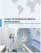 Global Intraoperative Medical Imaging Market 2017-2021